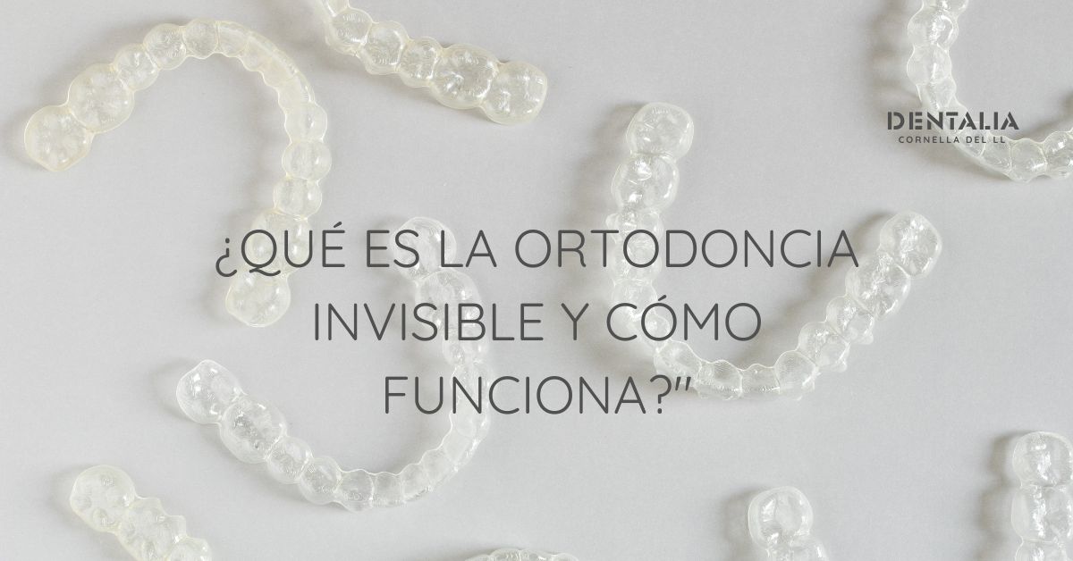 ¿Qué es la Ortodoncia Invisible y Cómo Funciona?